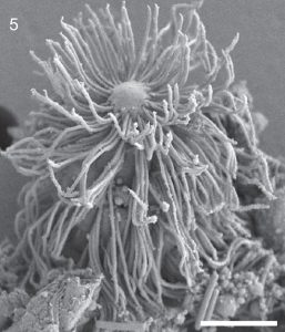 SEM image of Parasabalia (Spirotrichosomidae)