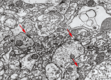 Large area imaging with Zeiss Atlas 5